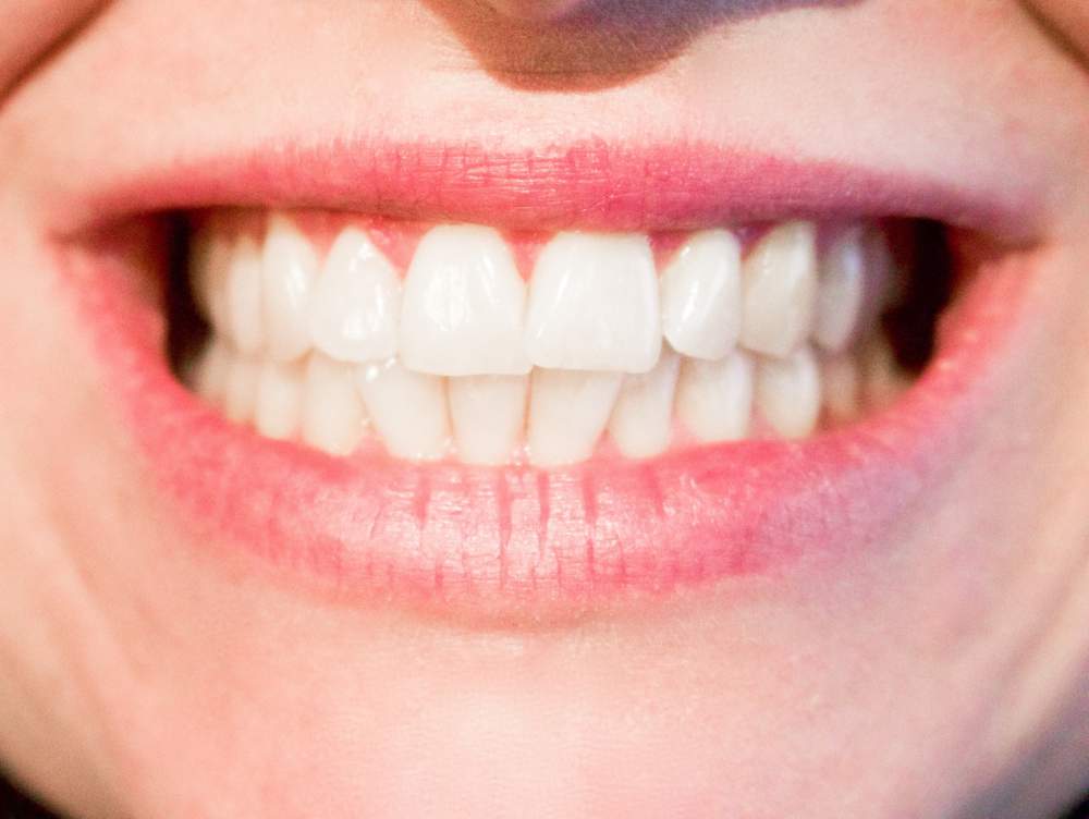 Di Addio Al Mal Di Denti I Rimedi Naturali Per Alleviare Il Dolore Terzo Binario News Di Addio Al Mal Di Denti I Rimedi Naturali Per Alleviare Il Dolore Terzo Binario News