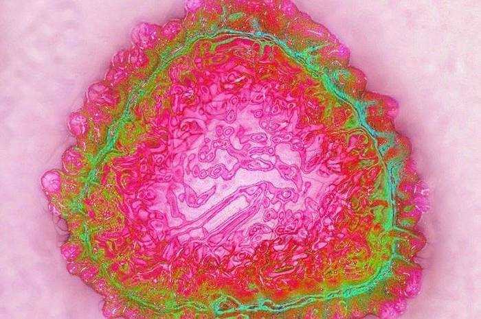 coronavirus 2 coronavirus 2