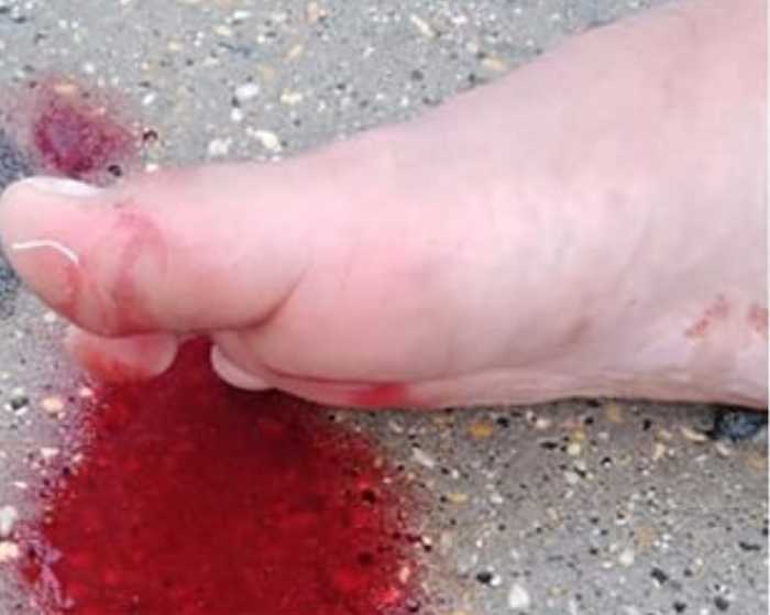 taglio spiaggia libera taglio spiaggia libera