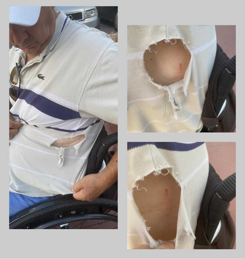 disabile aggredito cane polo strappata