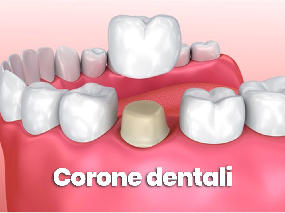 corone-dentali
